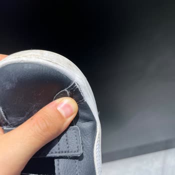 Kısa Sürede Deforme Olan Çocuk Ayakkabısı Ve İlgisiz İnceleme