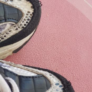 Skechers Ayakkabılarda Sürekli Deformasyon Ve Yetersiz Müşteri Desteği