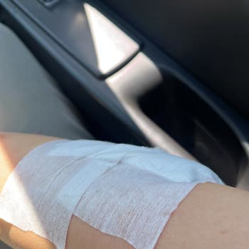 Garanti Kapsamında Parça Değişimi Yapılmadı, Kazaya Sebep Oldu