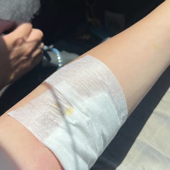 Garanti Kapsamında Parça Değişimi Yapılmadı, Kazaya Sebep Oldu