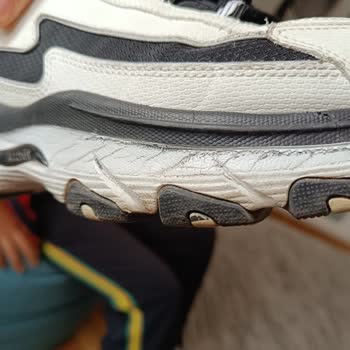 Kısa Sürede Yıpranan Ayakkabıya Olumsuz Müşteri Hizmetleri Yaklaşımı