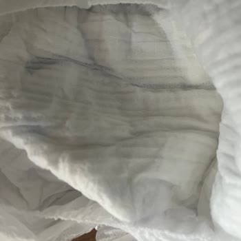 Molfix Bebek Bezinde Kristal Yapı Sorunu Ve Sağlık Endişesi