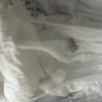Molfix Bebek Bezinde Kristal Yapı Sorunu Ve Sağlık Endişesi