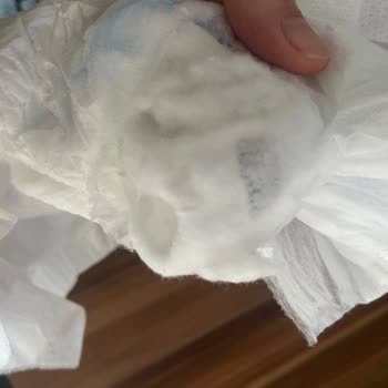 Molfix Bebek Bezinde Kristal Yapı Sorunu Ve Sağlık Endişesi