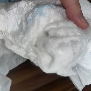 Molfix Bebek Bezinde Kristal Yapı Sorunu Ve Sağlık Endişesi