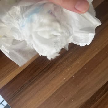 Molfix Bebek Bezinde Kristal Yapı Sorunu Ve Sağlık Endişesi