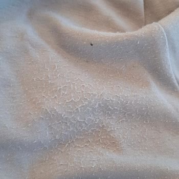 Yeni Alınan Pantolon İlk Kullanımda Tüylendi Fatura Bulunamıyor