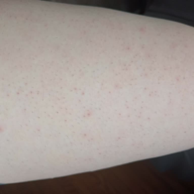 Epify Tüy Dökücü Sonrası Kaşıntı Ve Tahriş Yaşadım