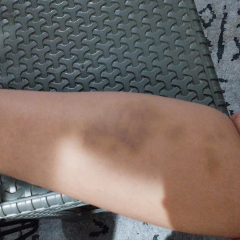 Kaydıraklarda Güvenlik Zafiyeti Ve Personel İlgisizliğiyle Paranızla Rezil Oluyorsunuz