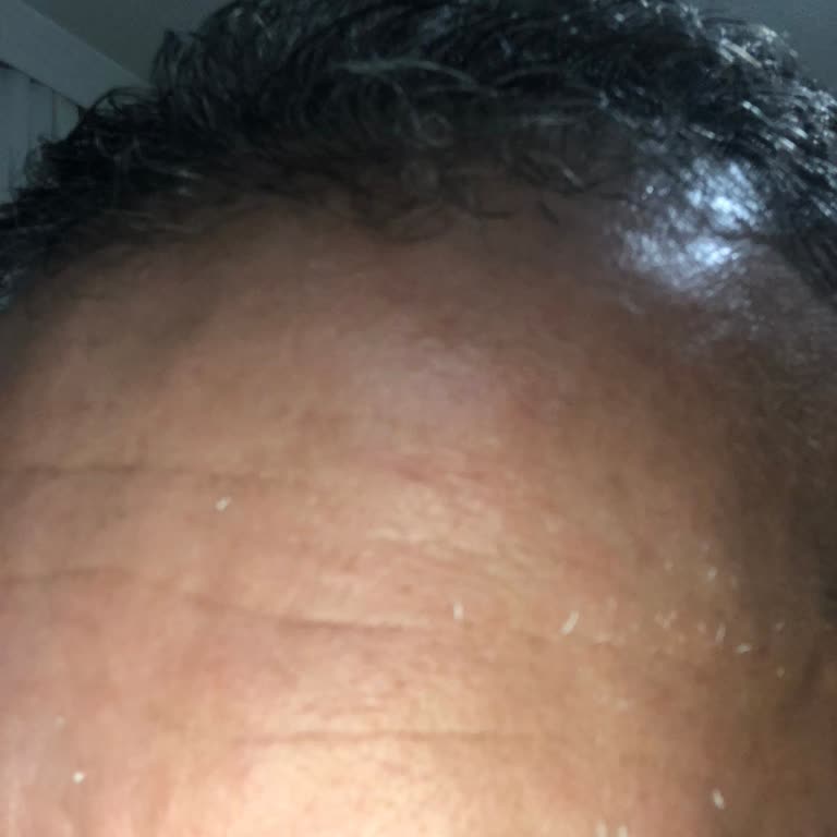 Bioderma Kusurlu Ürün İçin İade Kabul Edilmedi
