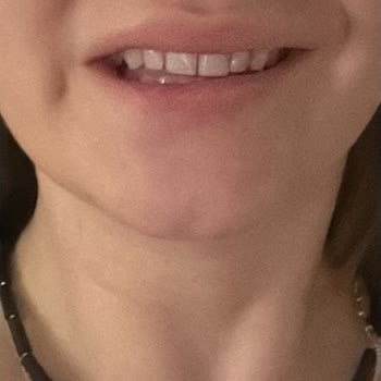 Doktorun İlgisizliği Ve Aceleci Tavrı Mağduriyet Yarattı