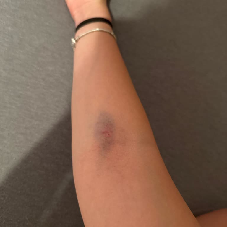 Ataşehir Hastanesinde Gece Acilinde İlgisizlik Ve İletişim Sorunu