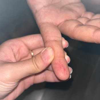 Otelin English Pub Girişinde Düşen Metal Parça Balayımızı Tehlikeye Attı