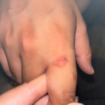 Otelin English Pub Girişinde Düşen Metal Parça Balayımızı Tehlikeye Attı