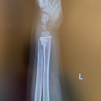 Acil Serviste Bekleme Ve Beklenmedik Yüksek Ücret Şoku