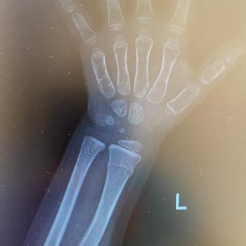 Acil Serviste Bekleme Ve Beklenmedik Yüksek Ücret Şoku