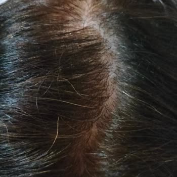 Aldığım Saç Boyası Beyazları Kapatmadı Ve Turunculaşma Yaptı