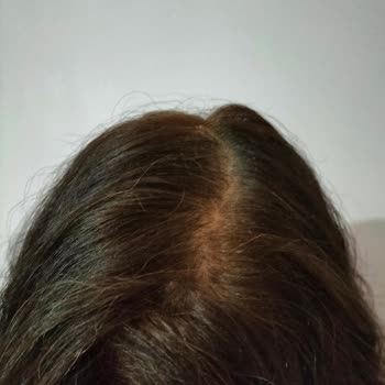 Aldığım Saç Boyası Beyazları Kapatmadı Ve Turunculaşma Yaptı