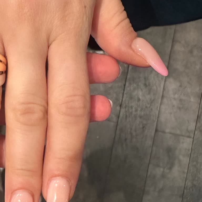 Uzman Olmayan Personel Ve Kötü Hizmet Deneyimi