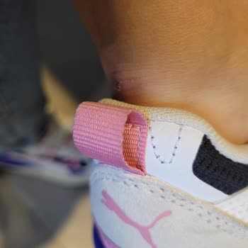 Aldığım Ayakkabılar Hem Deforme Oldu Hem De Koku Yaptı, Çözüm Yine Müşteri Aleyhine!