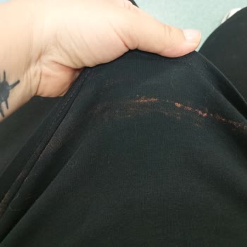 Yeditepe Üniversitesi Diş Hastanesi Lavabosunda Çamaşır Suyu Nedeniyle Kıyafetim Zarar Gördü