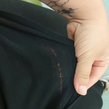 Yeditepe Üniversitesi Diş Hastanesi Lavabosunda Çamaşır Suyu Nedeniyle Kıyafetim Zarar Gördü