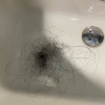 Emsal Doğan Güzellik Merkezi Keratin İşleminden Sonra Saçlarım Avuç Avuç Döküldü Ve Kopmalar Yaşadım