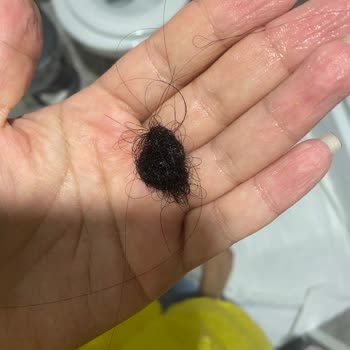 Emsal Doğan Güzellik Merkezi Keratin İşleminden Sonra Saçlarım Avuç Avuç Döküldü Ve Kopmalar Yaşadım