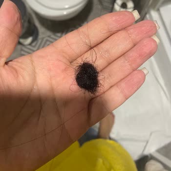 Emsal Doğan Güzellik Merkezi Keratin İşleminden Sonra Saçlarım Avuç Avuç Döküldü Ve Kopmalar Yaşadım