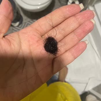 Emsal Doğan Güzellik Merkezi Keratin İşleminden Sonra Saçlarım Avuç Avuç Döküldü Ve Kopmalar Yaşadım