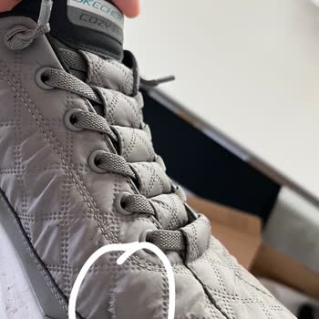 Hafta Sonu Giyilen Skechers Ayakkabı Kısa Sürede Yırtıldı Çözüm Bekliyorum