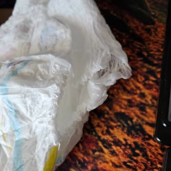 Molfix Külot Bezlerinde Yırtık Ve Kontrolsüz Paketleme Sorunu