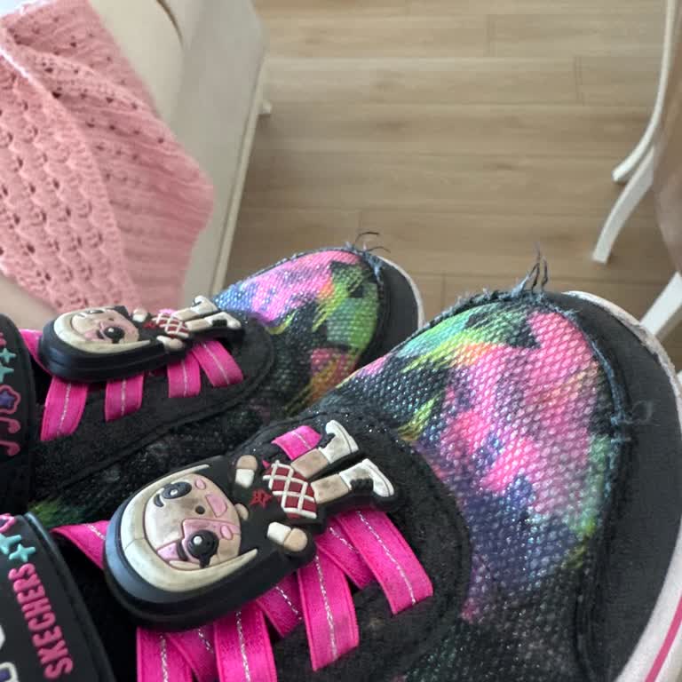 Skechers Ayakkabıda Kısa Sürede Yaşanan Kalite Sorunu Ve Olumsuz Müşteri Hizmeti