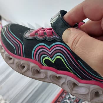 Skechers Ayakkabıda Kısa Sürede Yaşanan Arıza Ve Yetersiz Müşteri Desteği