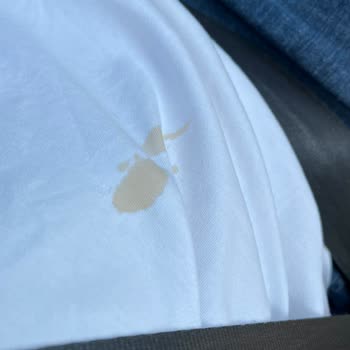 Starbucks Bardağının Kalitesizliği Tişörtümü Ve Aracımı Mahvetti