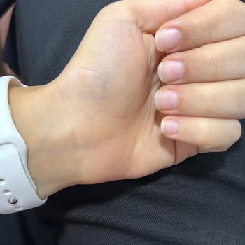 Pedikür Sırasında Yaşadığım Sağlık Sorunu Ve Salonun İlgisizliği Mağduriyetimi Artırdı