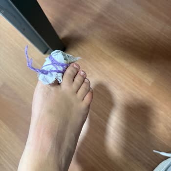 Pedikür Sırasında Yaşadığım Sağlık Sorunu Ve Salonun İlgisizliği Mağduriyetimi Artırdı