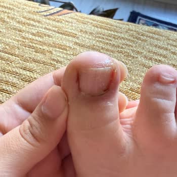 Pedikür Sırasında Yaşadığım Sağlık Sorunu Ve Salonun İlgisizliği Mağduriyetimi Artırdı