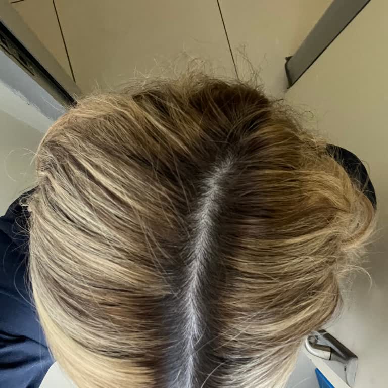 Saç Rengimde İstenmeyen Tonlar İçin Çözüm Yerine Ek Ücret Talebi