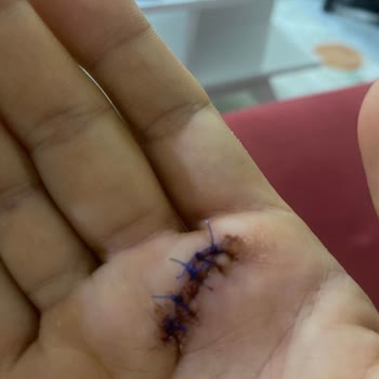 Hemşirelerin İlgisiz Ve Kaba Davranışı Nedeniyle Memnuniyetsizlik