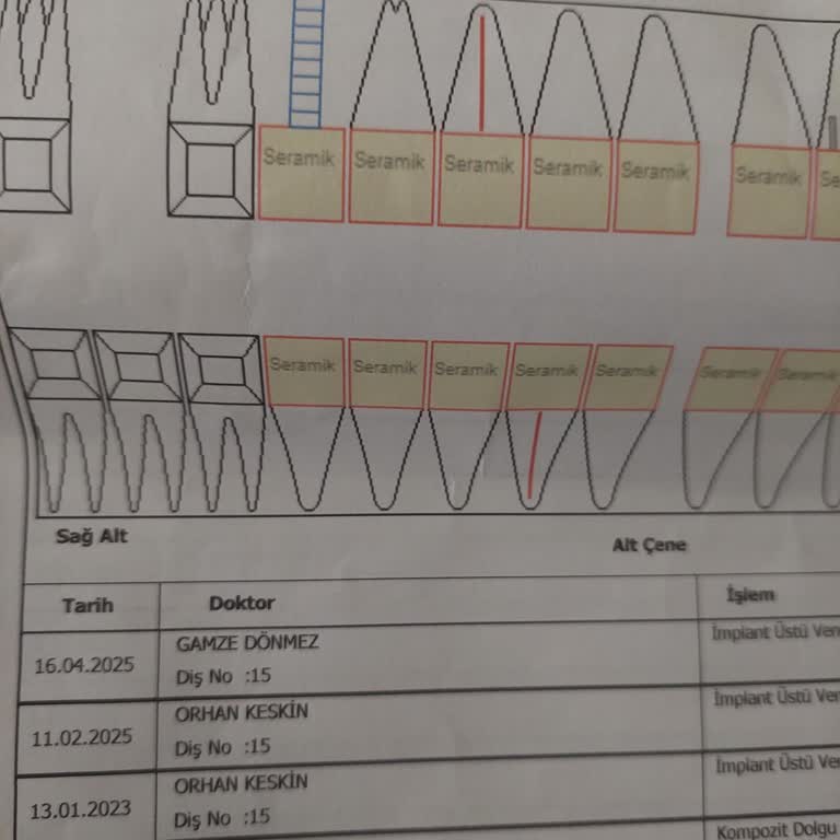 Başarısız İmplant Tedavisi Ve Yanıltıcı Bilgilendirme Nedeniyle Mağduriyet