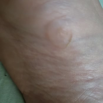 Polaris Terlik Tasarım Hatası Nedeniyle Yaşanan Mağduriyet