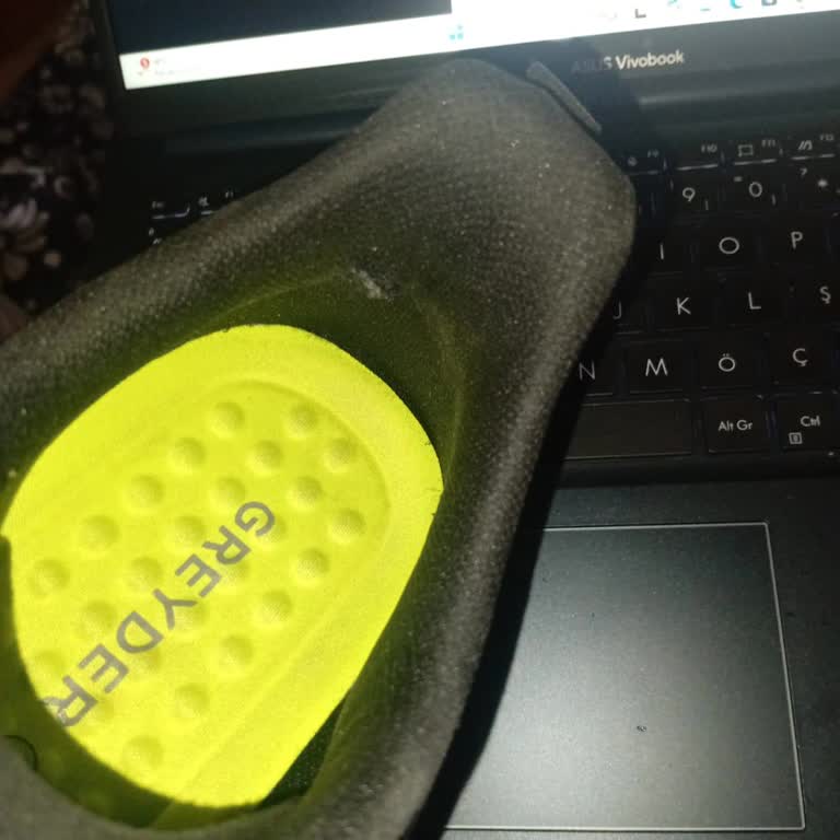 Ayakkabıda Hızlı Deformasyon Ve Garanti Sürecinde Sorun