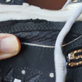 Skechers Ayakkabıda 5 Ayda Yırtılma Ve Üretim Hatası İddiası