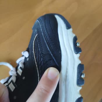 Skechers Ayakkabıda 5 Ayda Yırtılma Ve Üretim Hatası İddiası
