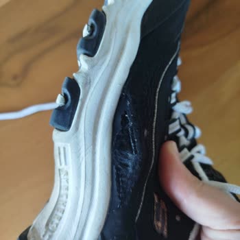 Skechers Ayakkabıda 5 Ayda Yırtılma Ve Üretim Hatası İddiası