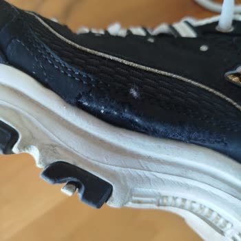 Skechers Ayakkabıda 5 Ayda Yırtılma Ve Üretim Hatası İddiası