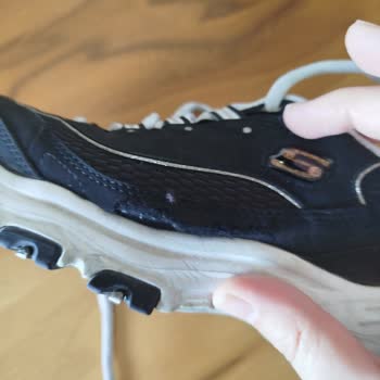 Skechers Ayakkabıda 5 Ayda Yırtılma Ve Üretim Hatası İddiası