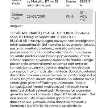 Bakımlı Elektrikli Bisikletin Fren Arızası Büyük Kazaya Yol Açtı Firma Sorumluluk Almıyor