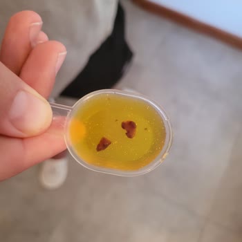 Argivit Focus Şişesinde Koyu Renkli Tortular Endişelendiriyor